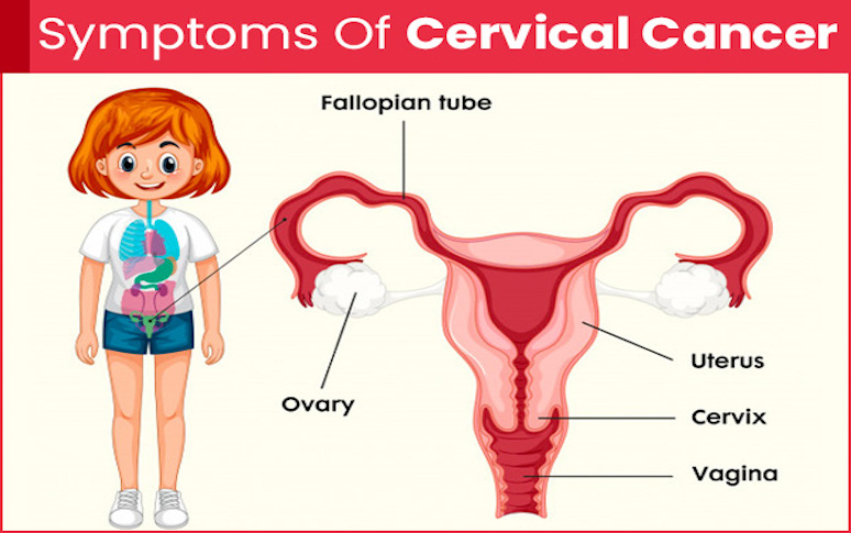 10-cancer-signs-women-should-be-alert-to-3.jpg