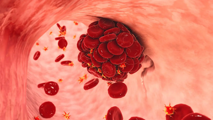 10-early-signs-you-might-have-lung-cancer-9.jpeg