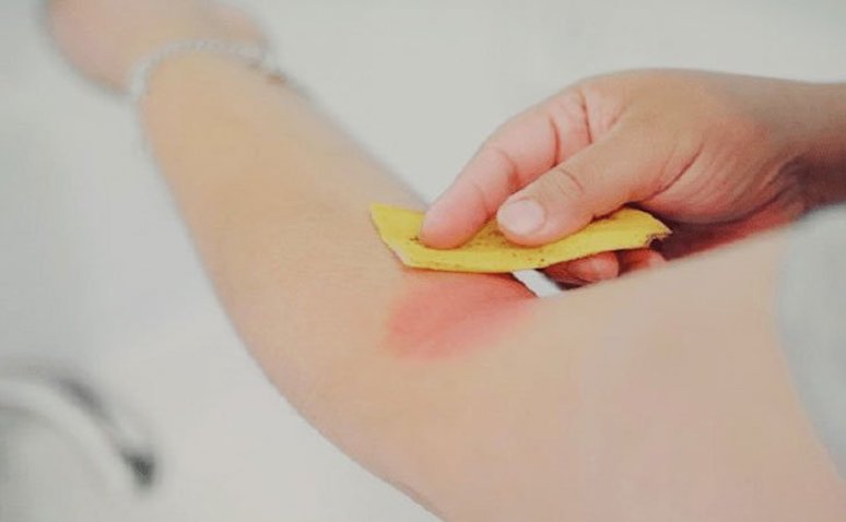14-surprising-things-banana-peels-can-do-for-you-8.jpg