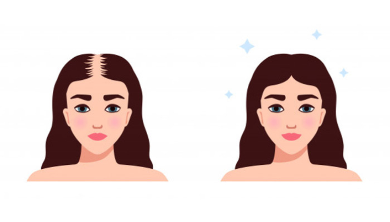 8-best-foods-to-stop-hair-loss-naturally-2.jpg