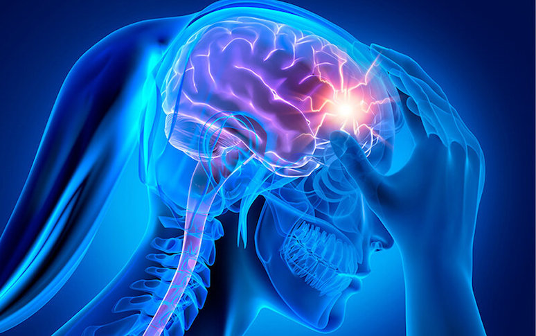 can-chocolate-trigger-migraine-heres-all-you-need-to-know-3.jpg